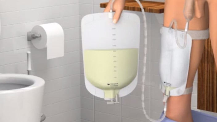 Opération fuites urinaires